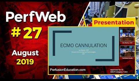 ECMO cannulation. Extracorporeal Membrane Oxygenation - Dr. Hany Samir